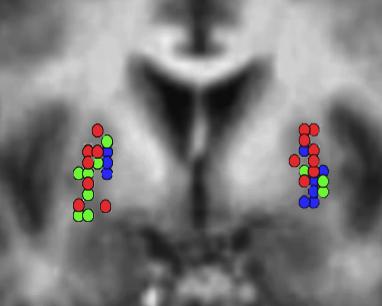 basal ganglia Foot hand lips fmri movements of body parts Delmaire et