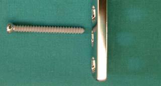 AO/ASIF screws in osteoporotic