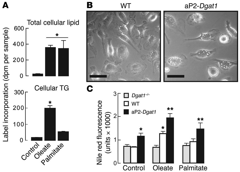 φ φ μ φ μ μ φ μμ fluid was similar in WT and ap2-dgat1 mice (Supplemental Figure 4D), indicating normal macrophage recruitment, and the mrna levels of M1 genes were similar in these cells