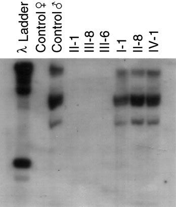 P.L.Chang, M.V.Sauer and S.Brown Figure 3. Southern blot with DAZ probe.