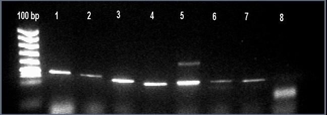 Figure 2: Optimized Multiplex PCR with all the eight primers 1 2 3 4 5 6 7 8 9 10 Figure 3: Multiplex A: lane 1, 100bp DNA Ladder; lane 2, DNA of normal fertile male as +ve Control; lane 3, female