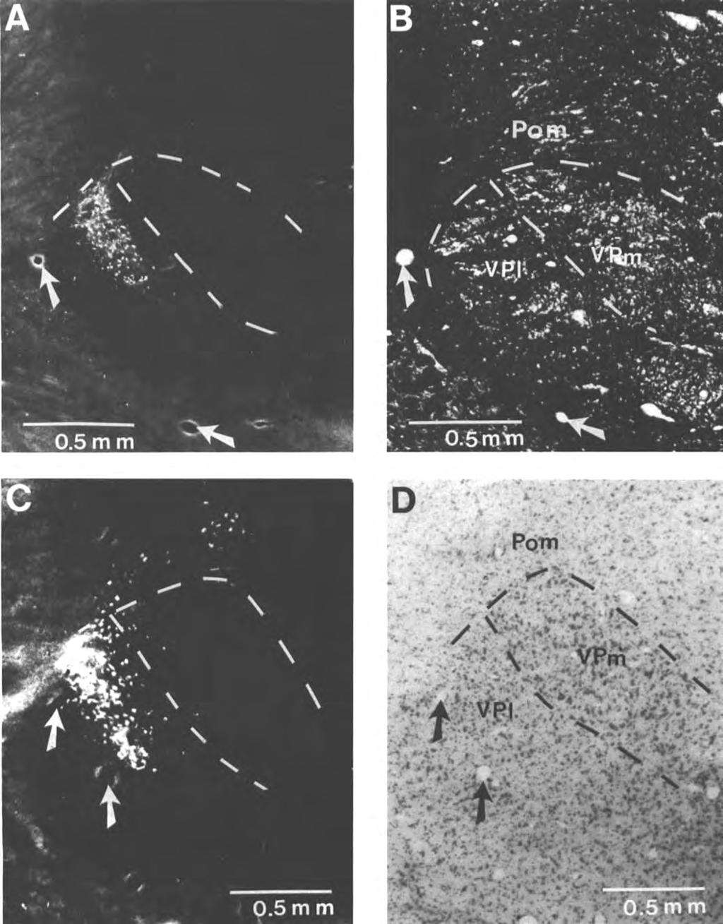 Fig. 14. Dark-field photomicrographs of anterograde and retrograde label in VPL after an injection in the forelimb representation in S-I1 in (A) case 84-95 and (C) case 84-54b.
