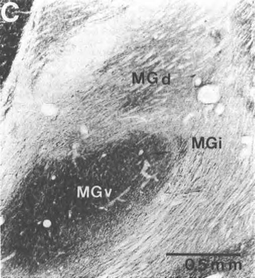 556 L.A. KRUBITZER AND J.H. KAAS Fig. 5. Light-field photomicrographs taken at intermediate levels of the medial geniculate complex. A. Nissl preparation, demonstrating that MGv is comprised of darkly staining, densely packed neurons of moderate size.