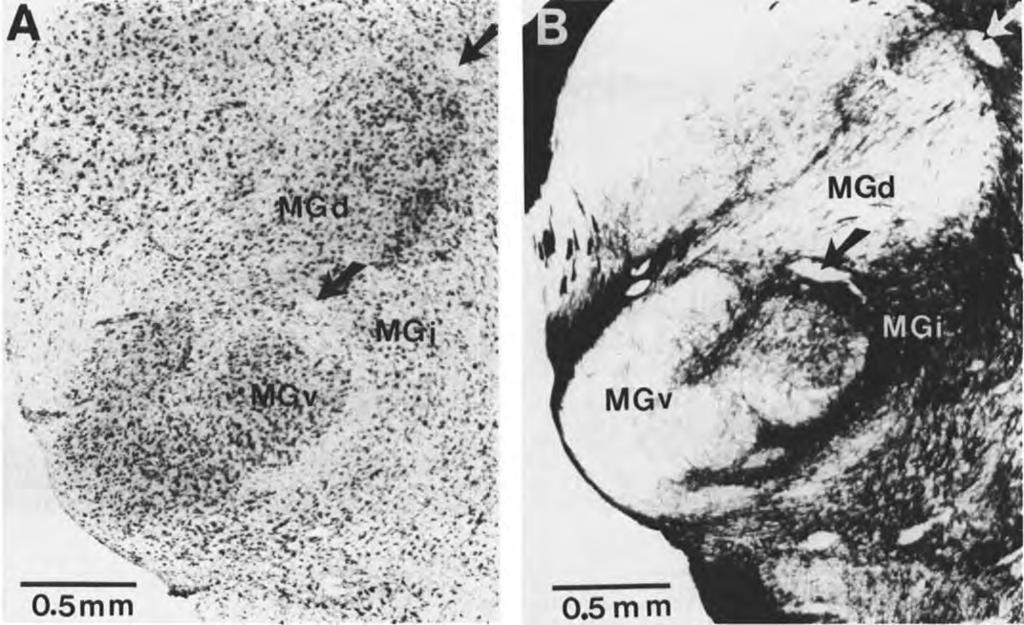 Section adjacent to that shown in A stained for myelin, showing that MGv and MGd are lightly myelinated, whereas the intervening MGi is heavily myelinated.