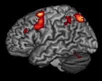 Functional Magnetic Resonance Imaging (fmri) Key Findings: Evidence for psychopharmacological effects on cerebral physiology (e.g., percent signal change in frontal lobe regions).