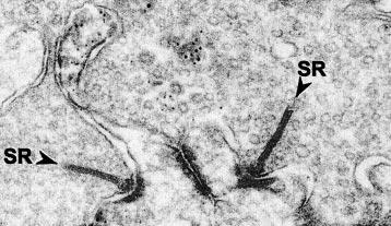 Neurotransmitter release at ribbon synapses 443 Figure 1 An electron micrograph of photoreceptor ribbon synapses in the rat retina. Synaptic ribbons (SR) are indicated with arrowheads.