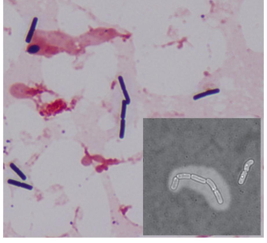 Blood culture pure culture of Bacillus cereus group organisms Pap