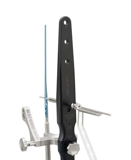 Fibula Rod System Features Minimally invasive surgical technique dramatically reduces complications due to large incisions required with plating.