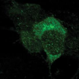 (red) and for Ret9 or Ret51 (green). Arrows highlight areas devoid of HuD staining. Scale bar, 4 μm.