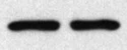 C D % of Endosomes occupied by RET 8 6 4 2 A IB: panret IB: ptyr IB: Tub TP GDNF (2mins) - + - + B M/min 5min Cell lysate 15min 3min 6min TP M/min 5min 15min 3min Streptavidin PD 6min % surface RET