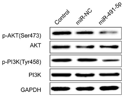 984 zhao et al: mir-491-5p suppresses cervical cancer cell growth by targeting htert Figure 3. mir-491-5p upregulation inhibits the migration and invasion of cervical cancer cells.
