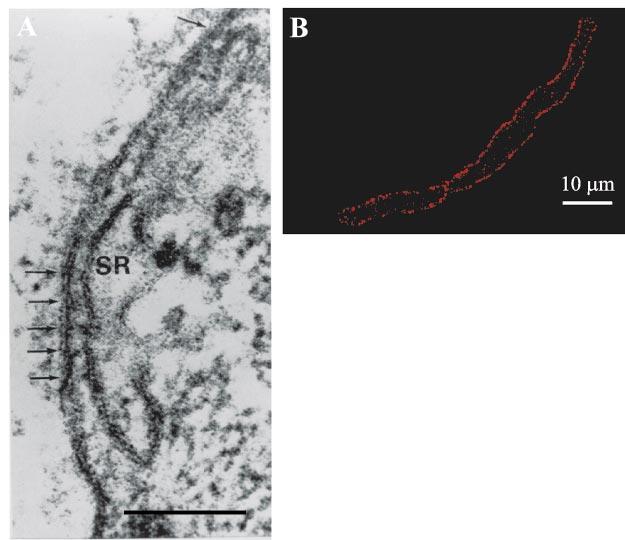 C238 INVITED REVIEW Fig. 3. A: surface coupling between junctional sarcoplasmic reticulum (SR) and plasma membrane: leaflets of SR and cell membranes are separated by an 12- to 20-nm gap.