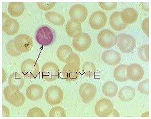 3. Lymphocytes Some produce ANTIBODIES Proteins that