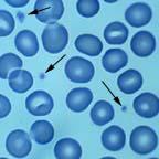 Platelets Pieces of cells that form when larger cells in the bone marrow break