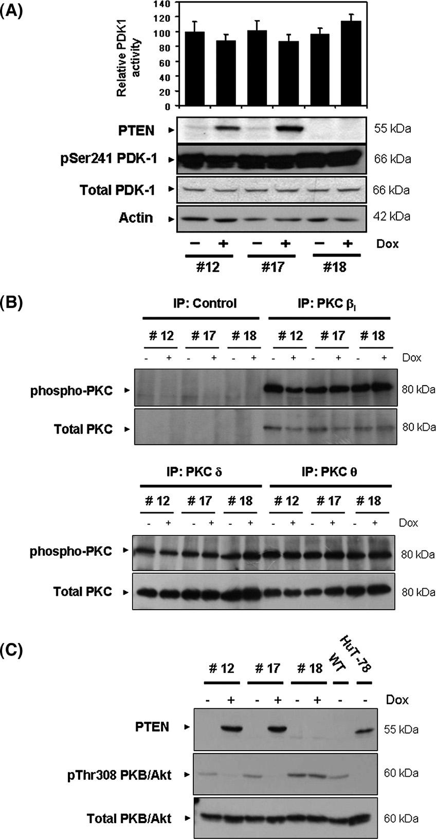 6 M. Freeley et al. / Cellular Signalling xx (2007) xxx xxx modulate the phosphorylation status of PKC θ at Thr538 in Jurkat cells (Supplementary Fig. 1).