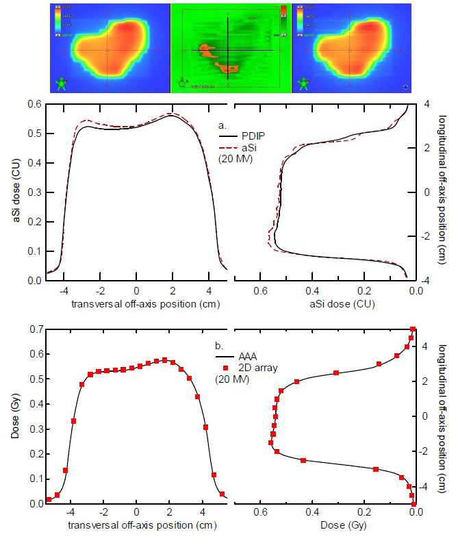 96 Van Esch et al.: Optimized asi portal dosimetry 96 Fig. 8. Portal dose deviations observed for the high photon energies.