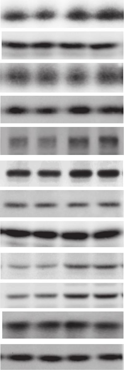 REGULATES BTB DYNAMICS C851 A p 123 133 653 517 453 394 M pci-neo pci-neo/, 177 p S-16, 385 p B TER (ohm cm 2 ) 6 5 4 3 2 1 Trnsfection PCR, IB pci-neo pci-neo/ 1 2 3 4 5 6 7 Time of Sertoli cells in