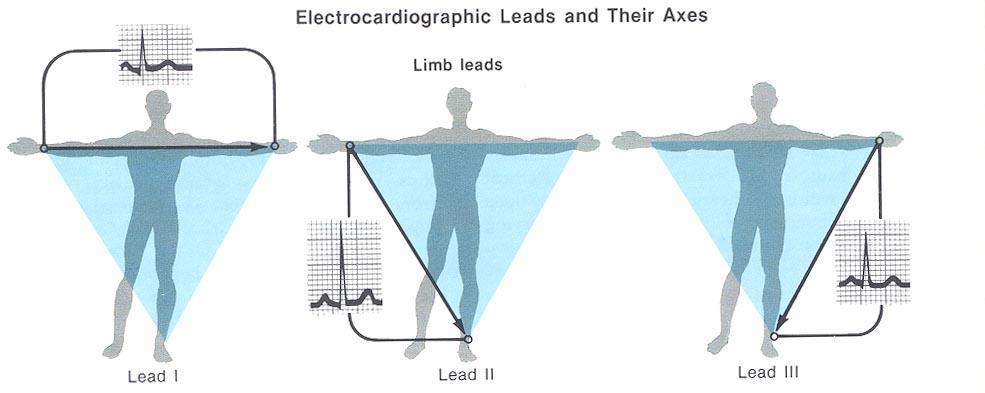 ECG Limb Leads As the ECG signal travels