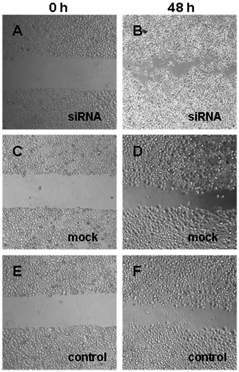 872 ZENG et al: SILENCING DICER PROMOTES CANCER CELL PROLIFERATION Figure 7. Silencing Dicer expression increases migration of Tca-8113 cells in Erasion Trace tests.