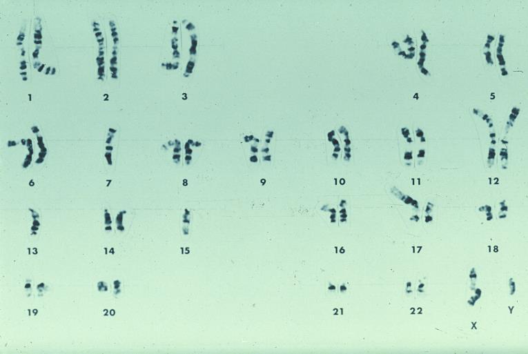 Case 4 63-year old female, fatigue, several infections during the last year: Hb 7,5 g/dl, MCV 103 fl, WBC 2.