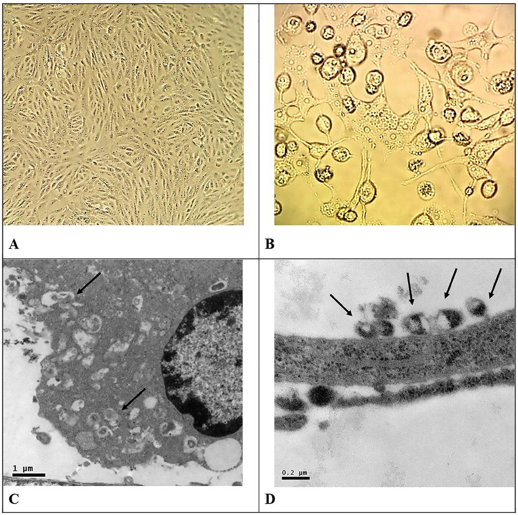 Fig. 1 - Morphological aspects of Vero cells infected with Zika virus (ZKV). A- Vero cell monolayers not infected with ZKV (A).
