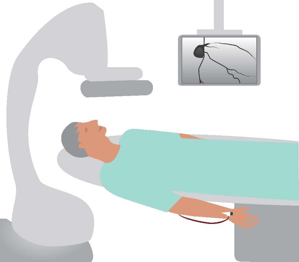 Coronary angiography Coronary angiography usually takes about 30 minutes. Your cardiologist will watch and monitor the procedure on a television screen. 1.