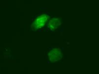 UCGUUUUUACACGUCACGGUUU-5 ACGA Y79 cells not transfected mir-182