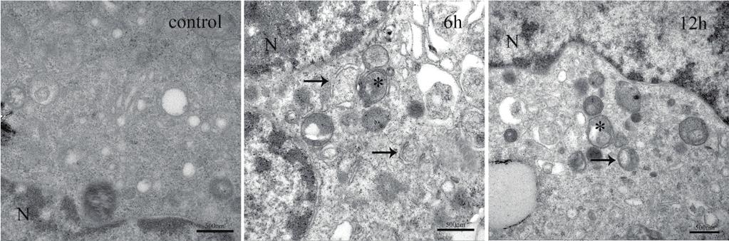 2 Mediators of Inflammation Figure 1: TEM images of HUVECs. HUVECs were exposed to (100 μg/ml) for 6 h and 12 h, and cell samples were collected for TEM analysis.