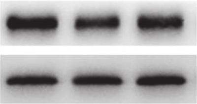 (a, c) qrt-pcr analysis of LC3 and p62. Results are the means ± SD of three separate experiments, p <005. (b, d) Western blot analysis of LC3-II and p62.