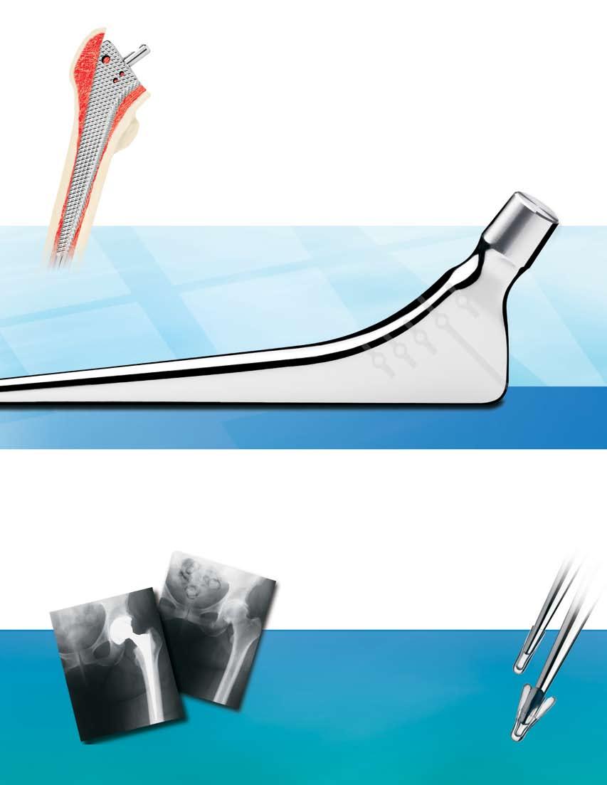 Single rasp per size Allows the surgeon to make intraoperative stem offset changes without re-rasping.