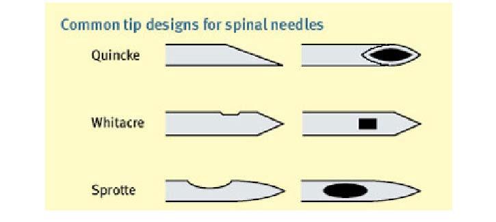 6 Spinal needles come in a variety of sizes (gauge and length) as well as bevel and tip designs. http://www.anaesthesiauk.com/images/lumbar-fig1.