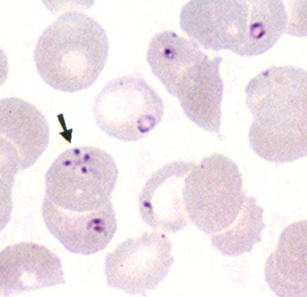 Life cycle of Babesia microti Sporoblasts/Sporozoites in salivary glands Trophozoite Zygote enters