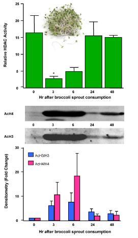 HDAC Inhibition by Sulforaphane-rich Broccoli Sprouts in