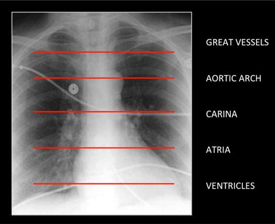 Indications for CT chest There are many indications for a CT chest (Table 2).