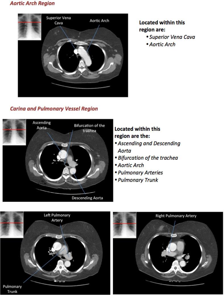 Fig 3 CT scans depicting anatomy at the levels of the aortic arch and carina. Suggested approach for CT chest interpretation: (i) A full review of the patient s history and examination.
