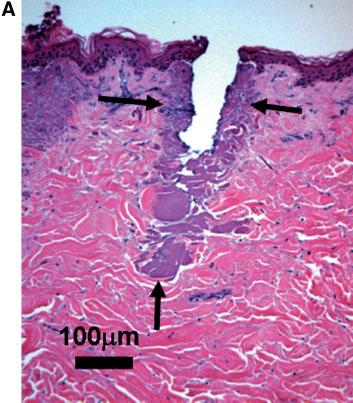 EX VIVO HISTOLOGICAL CHARACTERIZATION 89 Fig. 1. Ex vivo human abdominal tissue treated with the 30 W, 10.6 mmco 2 laser at 9.2 mj (A), 13.