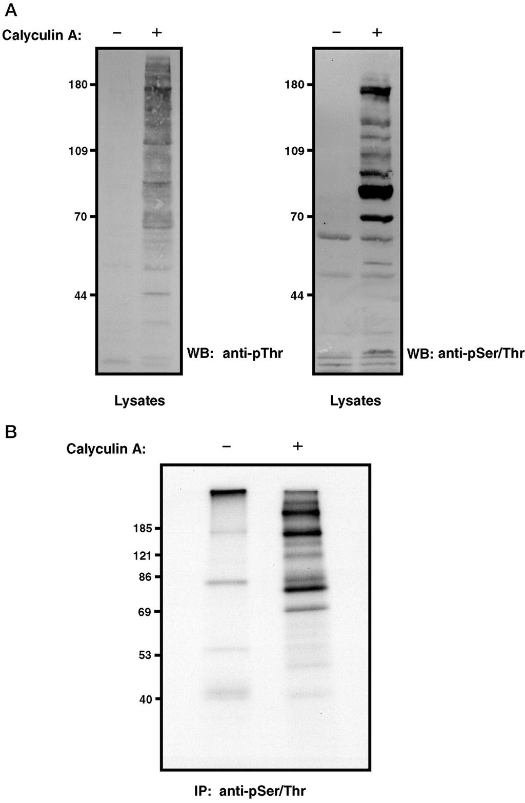 Phosphorylation in Hela cells stimulated by calyculin Western blot analysis
