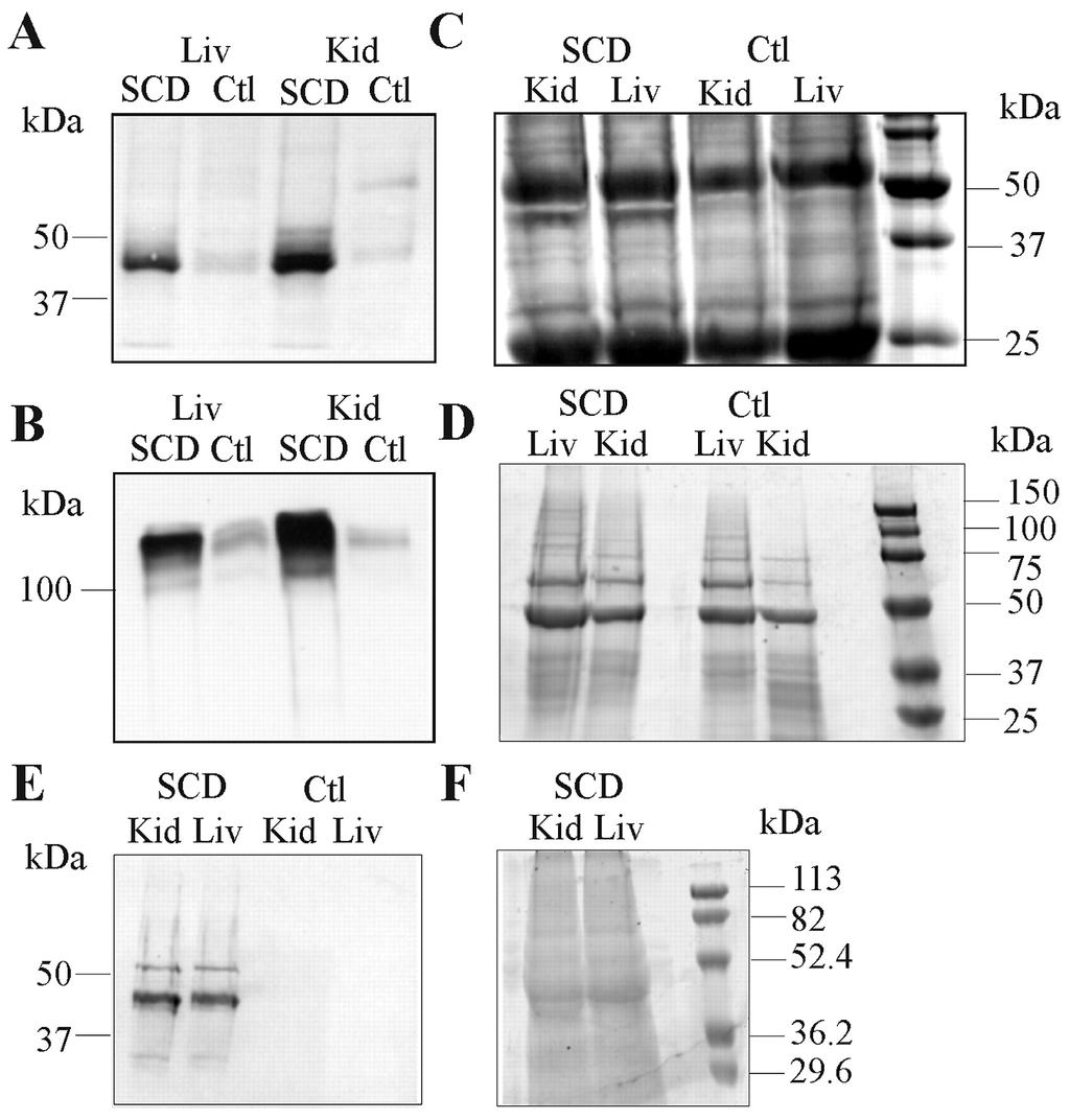 SDS-PAGE and Western blot analysis A = anti-nitrotyrosine and liver and kidney homogenates B = anti-inos C = immunoprecitated NO2Tyr proteins run on SDS-PAGE and stained by Coomassie Blue D =