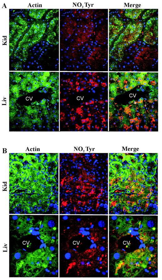 Evidence that actin and the anti-no 2 Tyr immunoreactivity are co-localized Tissue sections of kidney and liver from humans (A) and mice (B) with sickle cell