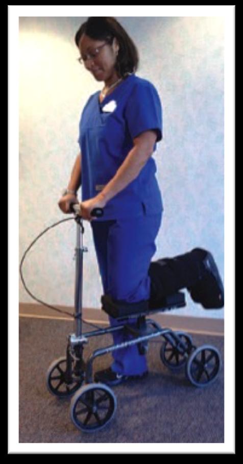 Post-Opera5ve Use of the Wheeled Knee Walker a<er Foot and Ankle Surgery AOFAS ANNUAL MEETING EPOSTER, JULY 12-15, 2017 JANE C.