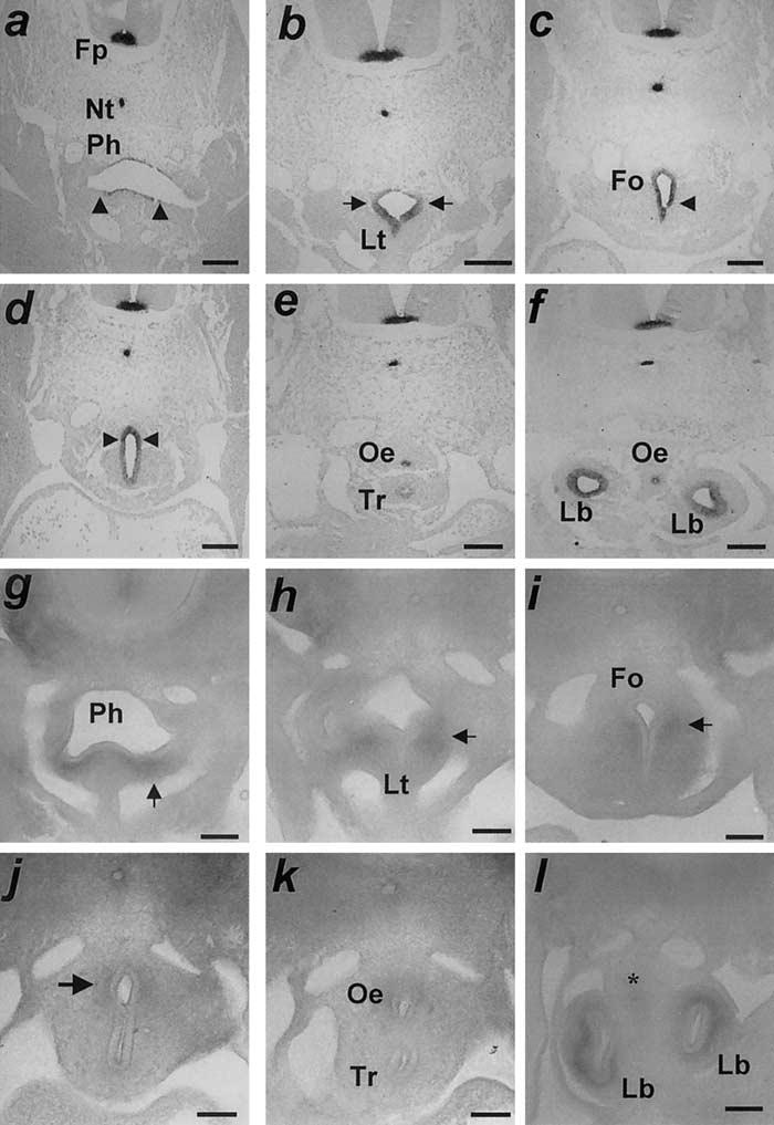32 IOANNIDES ET AL Fig 2. Changing patterns of Shh expression and complementary Ptc1 patterns in E11.5 saline-treated embryos.