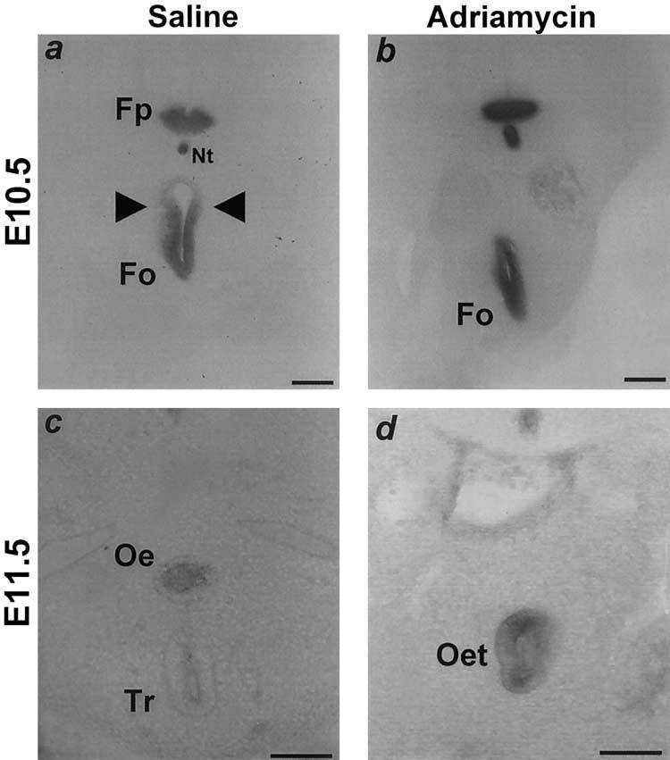 34 IOANNIDES ET AL Fig 4. The ventral-to-dorsal switch in Shh expression is disturbed in Adriamycin-treated embryos.