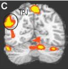 jpg LKM + task in scanner or Greater increases in Insula (emotional arousal