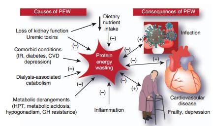 The concept of «vicious circle» of PEW in CKD/ESRD: PEW leads to complications, complications lead to PEW The