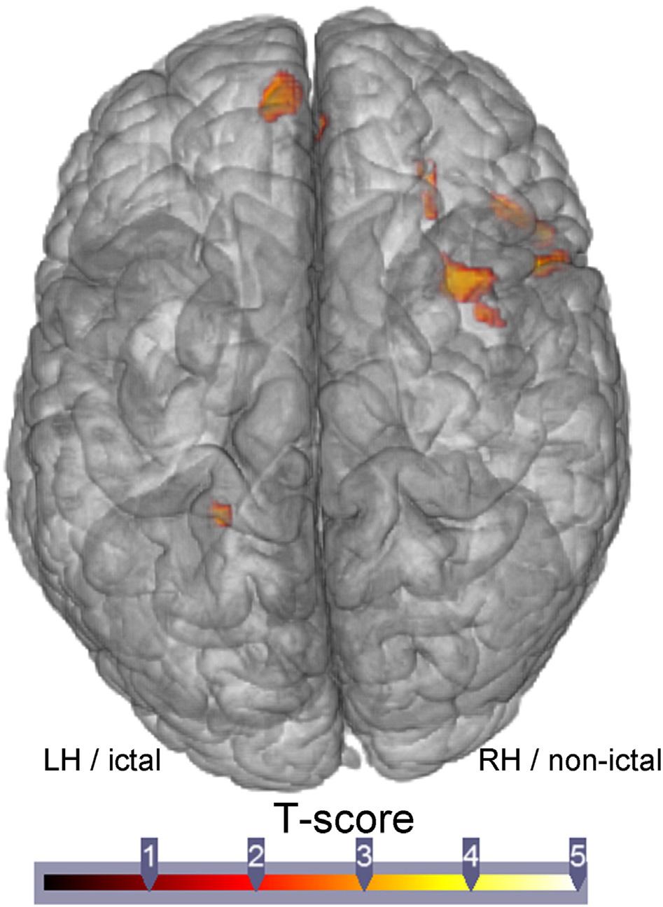 G.E. Doucet et al. / NeuroImage: Clinical 9 (2015) 458 