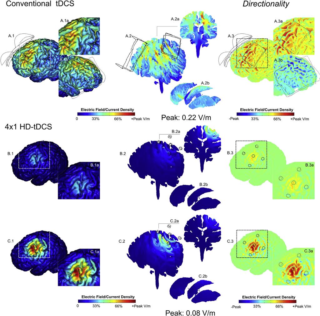 646 H.-I. Kuo et al. / Brain Stimulation 6 (2013) 644e648 Figure 1. FEM model of brain current flow during conventional and 431 HD-tDCS.