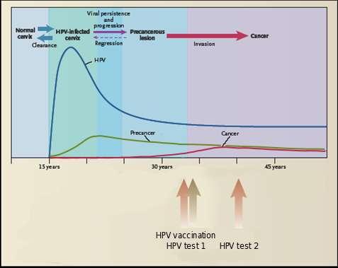 Integration of HPV