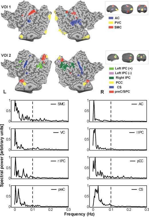 ICA of Resting State Functional Connectivity Figure 1. Upper panel: COIs obtained by using the first (VOI 1) and second (VOI 2) set of VOIs of Subject 6. Colors indicate the different COIs.