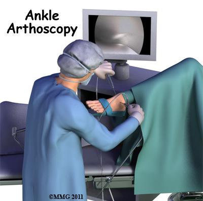 How does the ankle joint work? The ankle joint is formed by the connection of three bones.