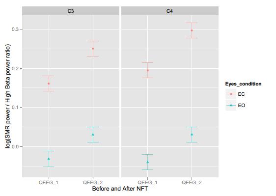 Changes in the QEEG after NFT 14 Figure 4. Plot of comparison of means and standard errors of SMR/High Beta ratio before and after neurofeedback training (NFT).